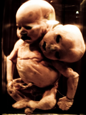 Mutter Museum (Philadelphia)