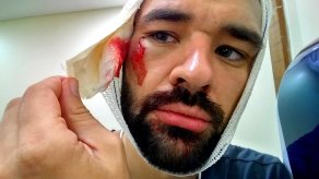 Pre-stitches (Dealing with Physical Violence) Pre-stitches (Dealing with Physical Violence)