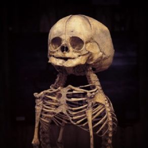 11379797_1481881322103202_1356104450_n (Instagram Download) 11379797_1481881322103202_1356104450_n (Instagram Download)
